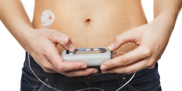 Crianças até 10 anos com diabetes tipo 1 terão acesso gratuito às bombas de insulina
