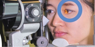 Estudo: 16,3% das pessoas com diabetes têm retinopatia diabética